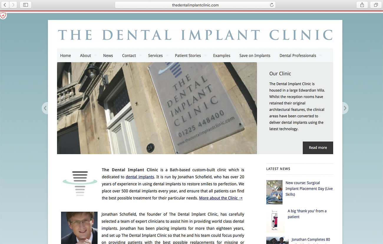 Dental Implant Clinic website interface - Marketing for dental clinics